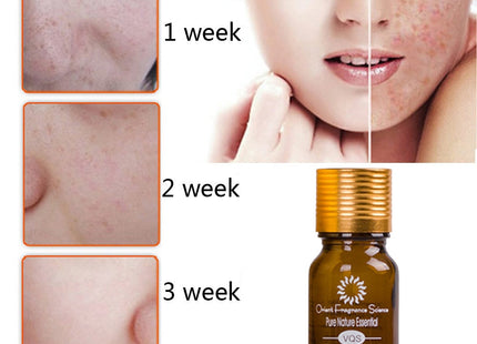 Dredge Meridian Skin Care Natural Pure Removal Acne Stretch Marks Scar Removal Essence oil